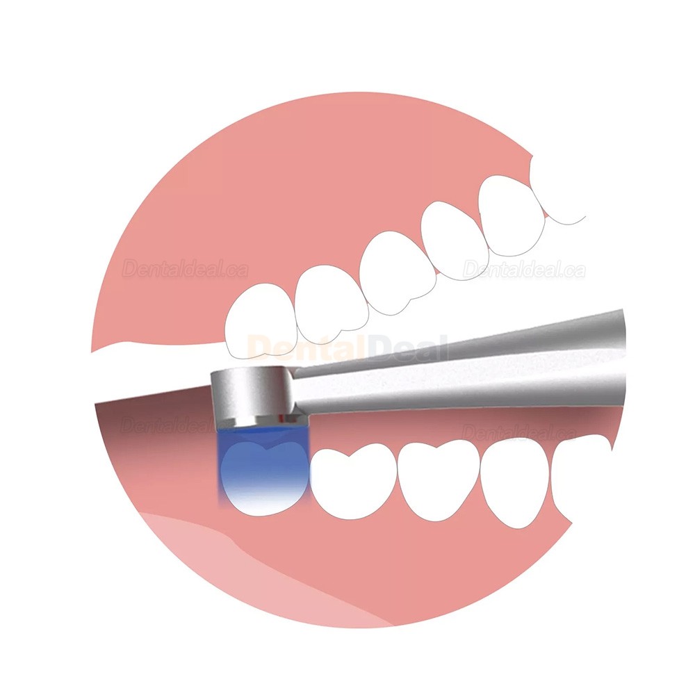 Betterway C25 Plus Dental Cordless LED Curing Light with Head